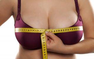 Breast Reduction Surgery