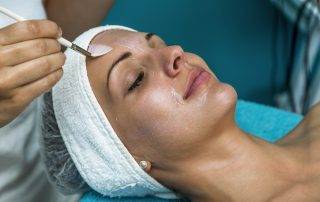 What is a Chemical Peel