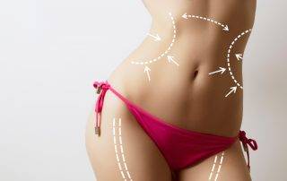 vaser Liposuction Surgery