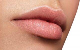 How to Avoid Overfilled Lips