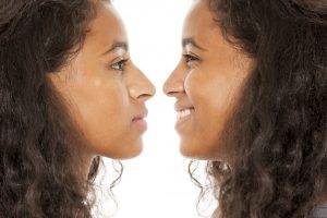Things to Know About wide nose Rhinoplasty