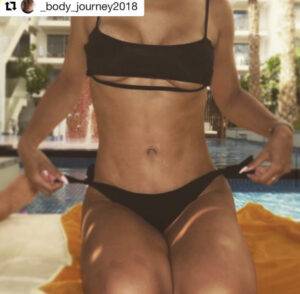 tummy tuck manchester results mummy makeover london cost