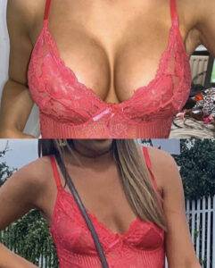 boob job before and after