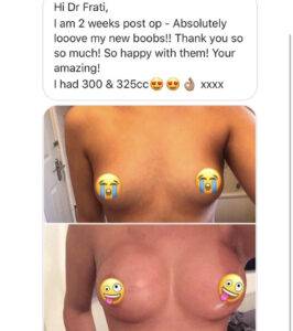 boob job before and after review