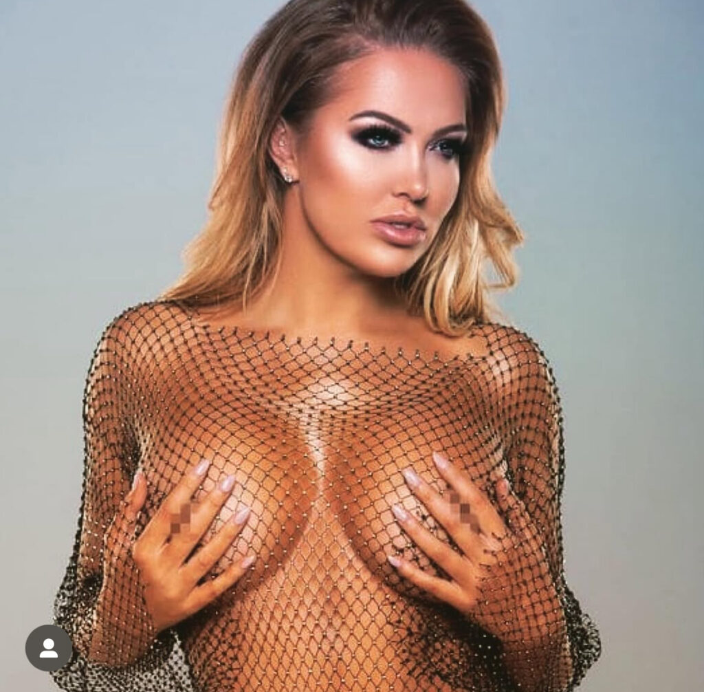 aisleyne breast uplift london cost result